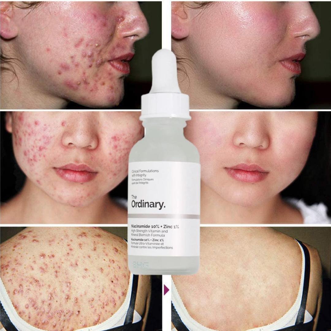 Kit Niacinamidasalicilicohialuronico